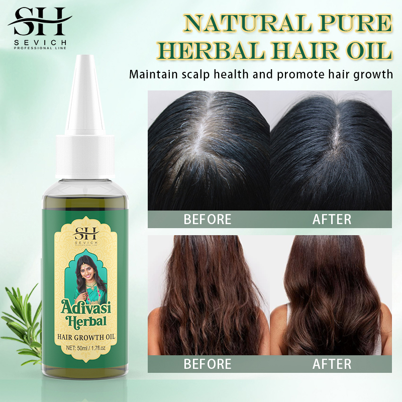 Óleo ayurvédico para crescimen - Coconut Oil Refined avaliação e preço