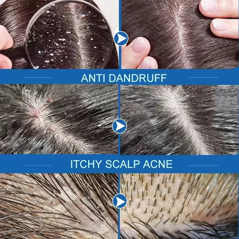 Sabonete de tratamento capilar - Castor Oil Soap avaliação e preço