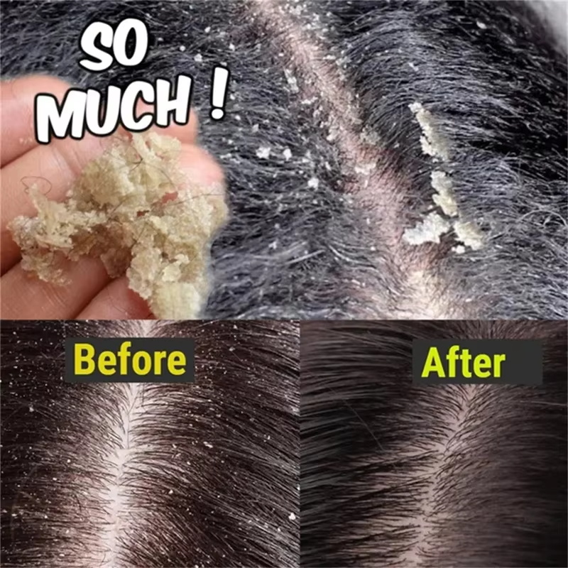 Sabonete de tratamento capilar - Castor Oil Soap avaliação e preço